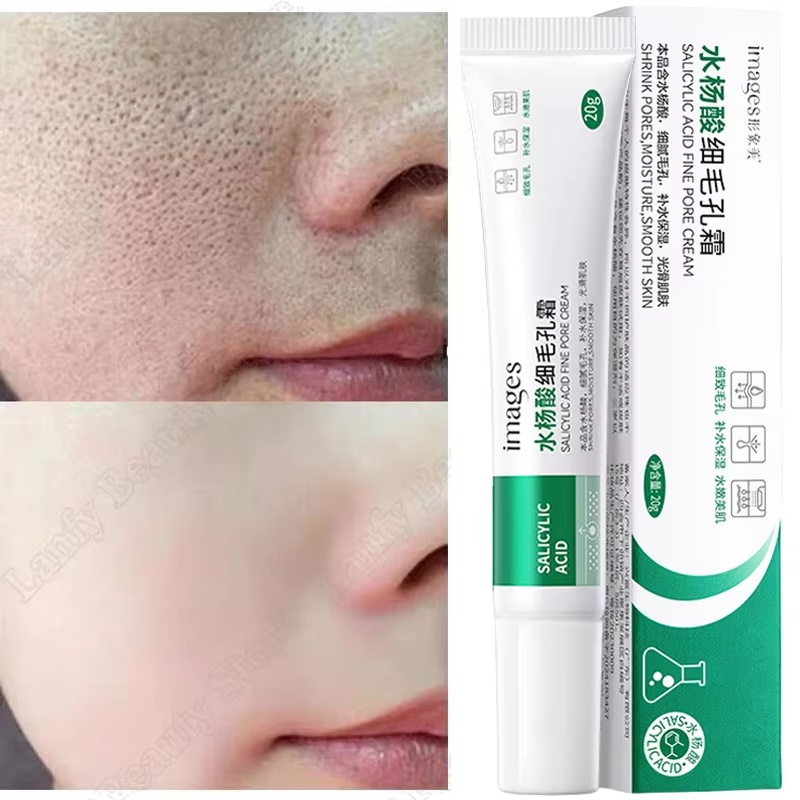Salicylic Acid Blackhead Remover - Salicylic Acid Pore Clearing Cream Shrink