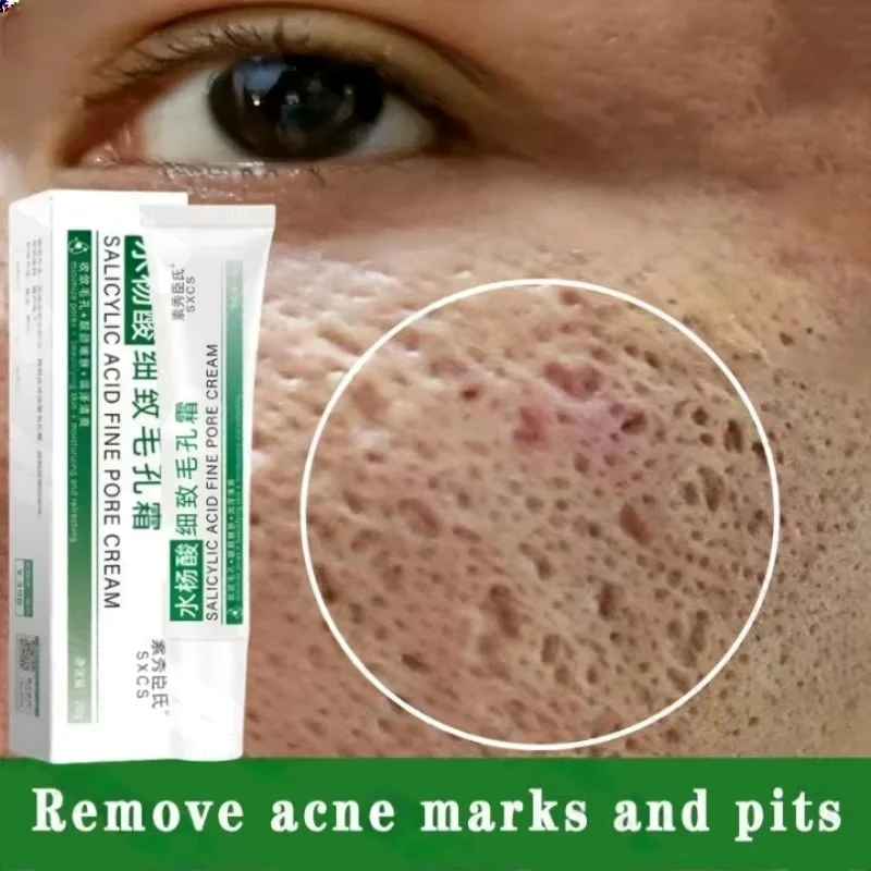 Salicylic Acid Pore Clearing C - đánh giá và giá Salicylic Acid Blackhead Remover