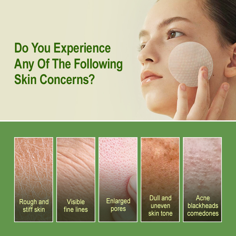 Salicylic Acid Exfoliating Pad - đánh giá và giá Salicylic Acid Blackhead Remover