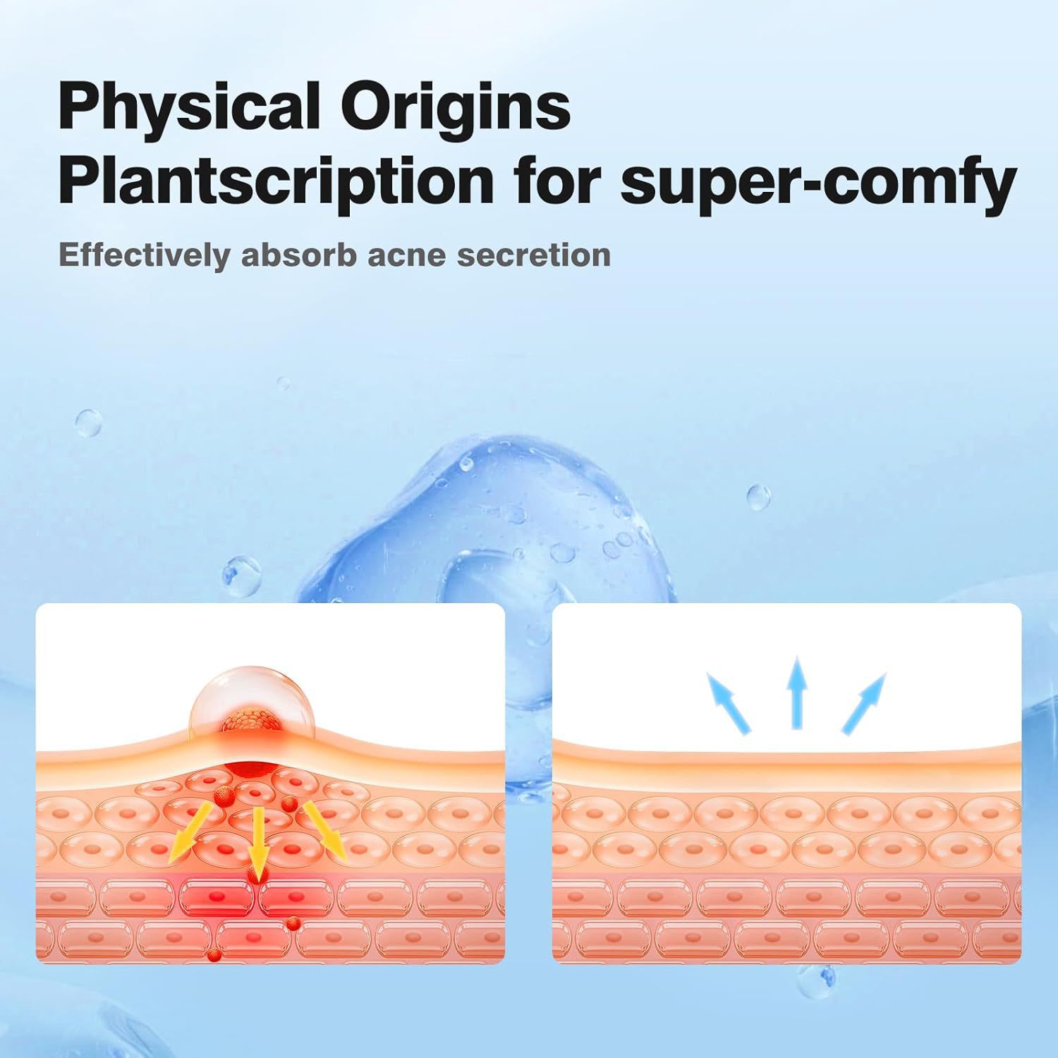 360 pieces/box acne patches -  - đánh giá và giá Massage