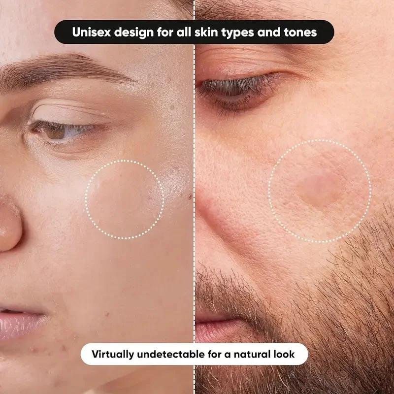 360 pieces/box acne patches -  - đánh giá và giá Massage