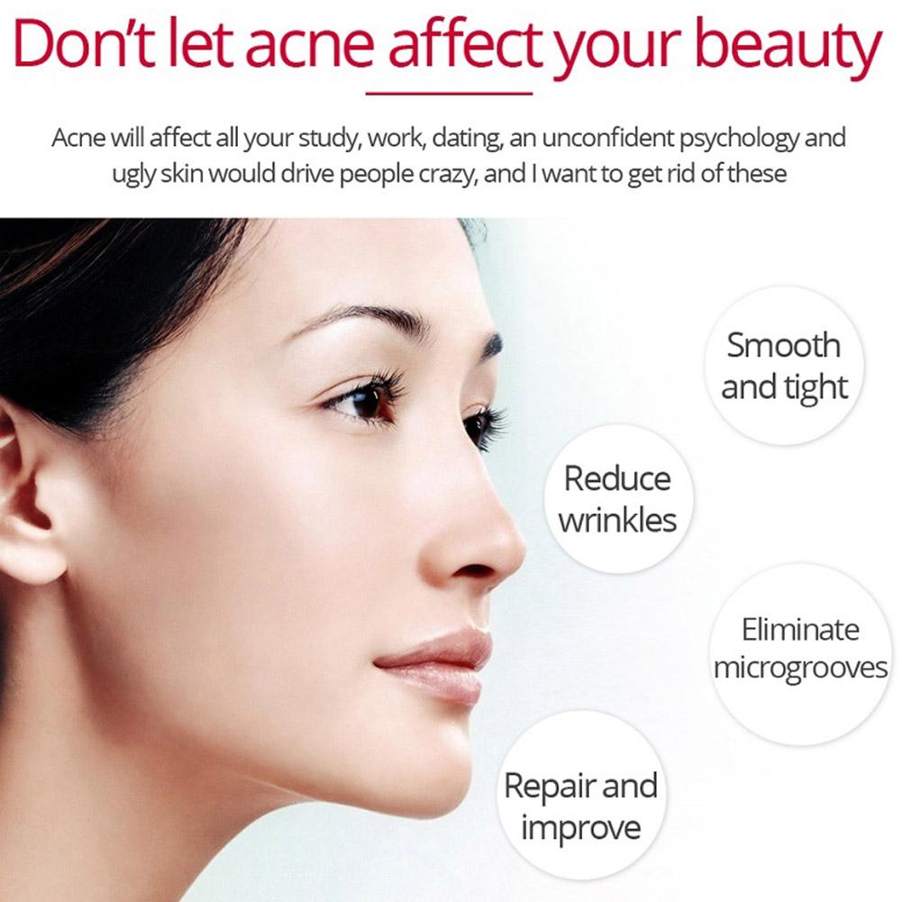 Retinol Nâng Săn Chắc Da Loại  - đánh giá và giá Retinol Anti Wrinkle Cream