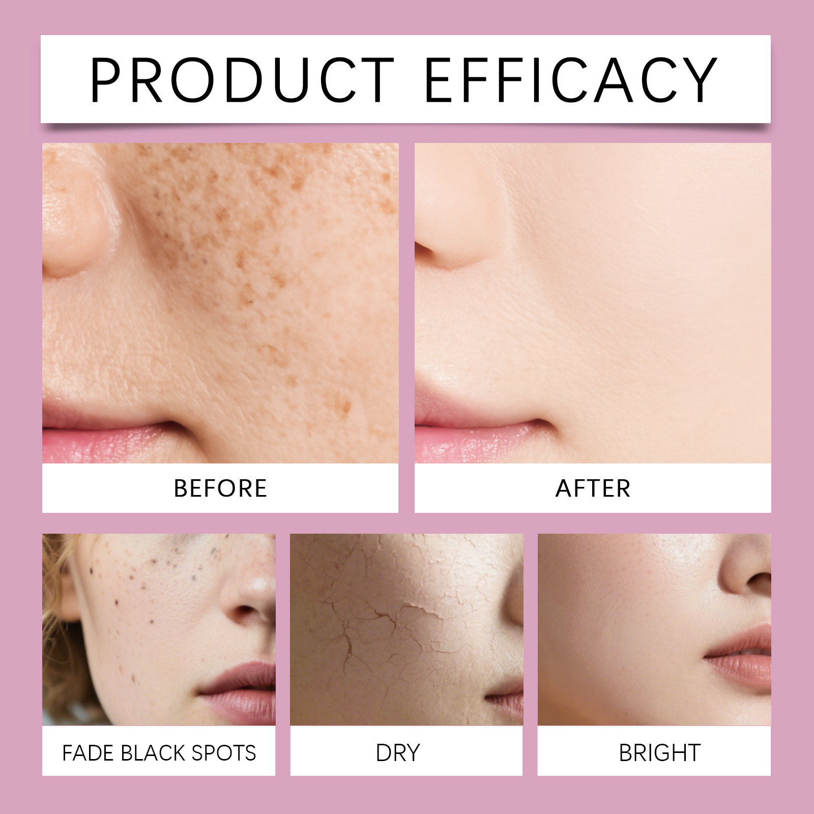 Korean Calcium Collagen Skinca - đánh giá và giá Hyaluronic Acid Facial Serum