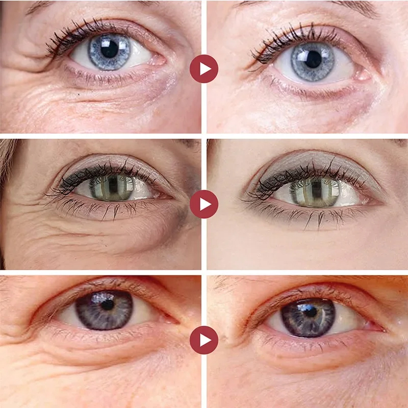 Wrinkle Remove Eyes Patches Fi - đánh giá và giá Collagen Under Eye Patches