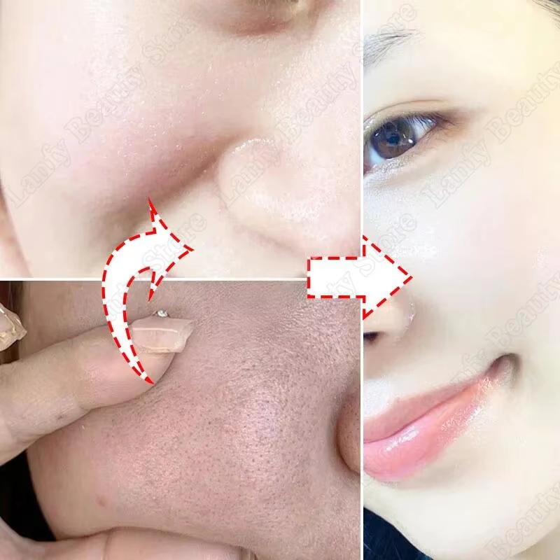 Salicylic Acid Pore Clearing C - đánh giá và giá Salicylic Acid Blackhead Remover